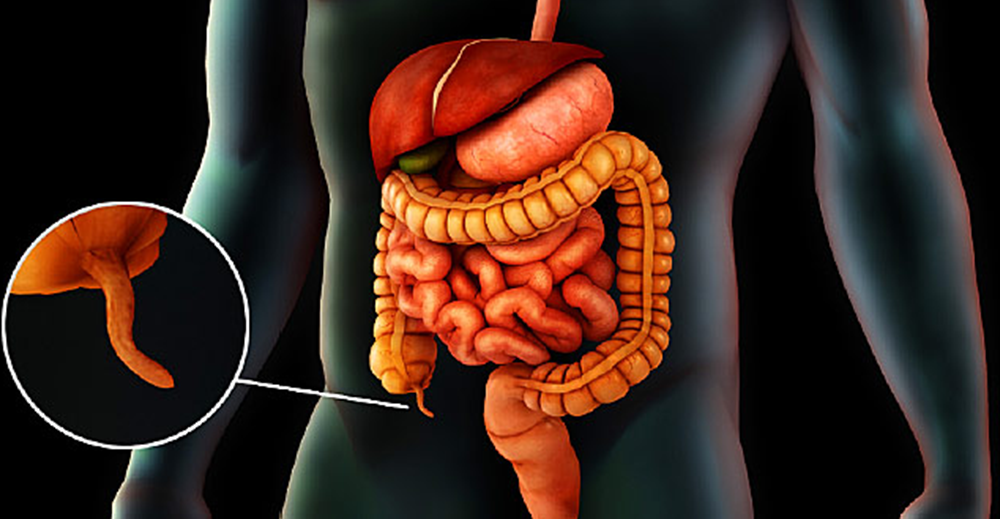 عملية استئصال الزائدة الدودية بالمنظار