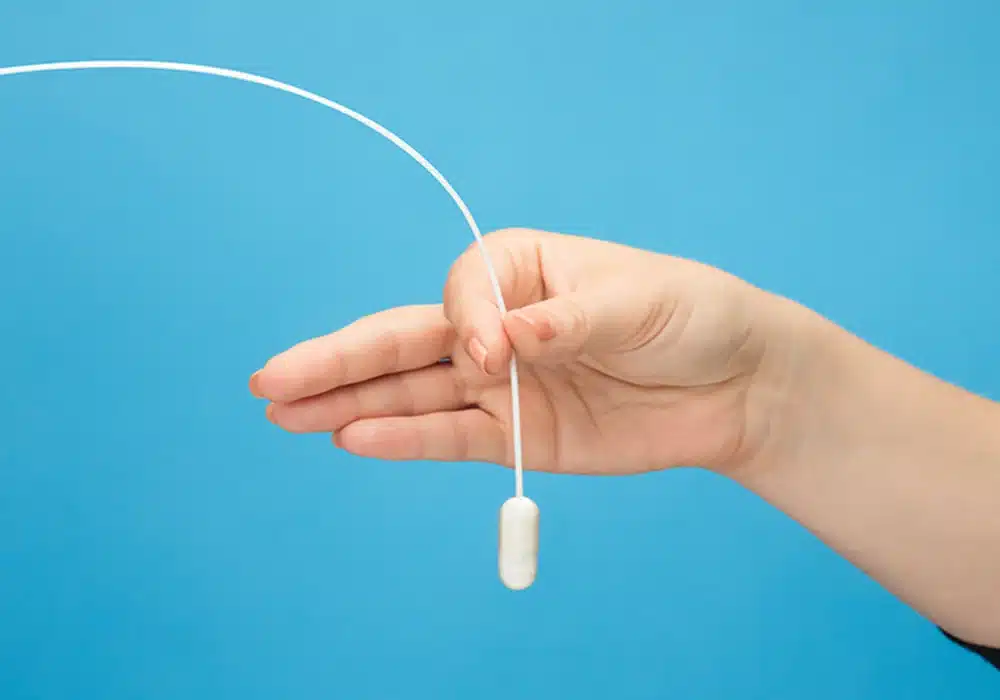 الكبسولة الذكية – بالون المعدة